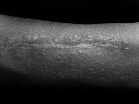 scar_1 scar_1